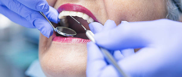 Best Emergency Root Canal Treatment in Lake Mack Forest Hills, FL